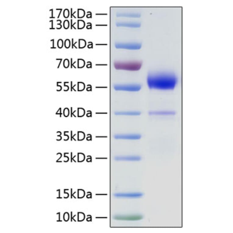 SDS-PAGE - Recombinant Human VEGF-B Protein (N-terminal Human Fc Tag) (A331417) - Antibodies.com