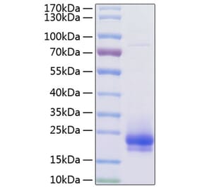 SDS-PAGE - Recombinant Human VEGFC Protein (C-terminal His Tag) (A331418) - Antibodies.com