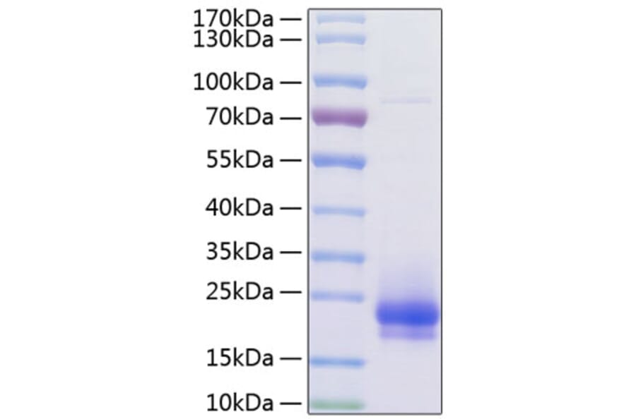 SDS-PAGE - Recombinant Human VEGFC Protein (C-terminal His Tag) (A331418) - Antibodies.com
