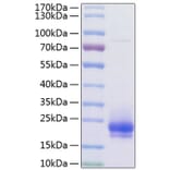 SDS-PAGE - Recombinant Human VEGFC Protein (C-terminal His Tag) (A331418) - Antibodies.com