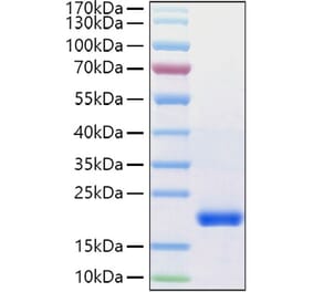 SDS-PAGE - Recombinant Human VEGFD Protein (C-terminal His Tag) (A331419) - Antibodies.com