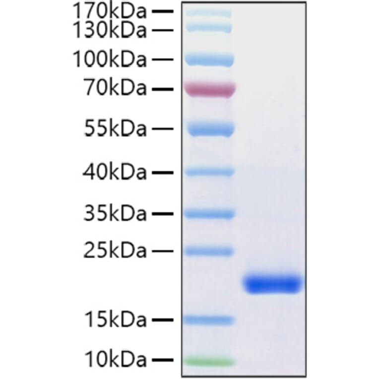 SDS-PAGE - Recombinant Human VEGFD Protein (C-terminal His Tag) (A331419) - Antibodies.com