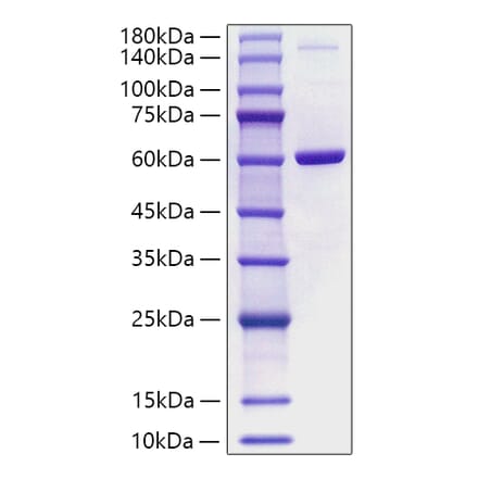 SDS-PAGE - Recombinant Human Visfatin Protein (A331421) - Antibodies.com