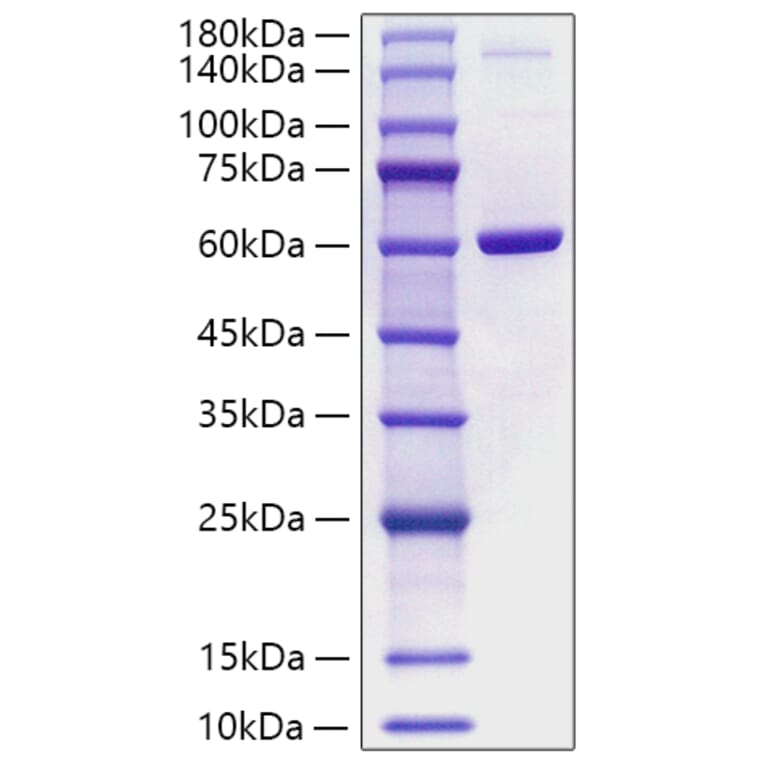 SDS-PAGE - Recombinant Human Visfatin Protein (A331421) - Antibodies.com