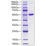 SDS-PAGE - Recombinant Human Visfatin Protein (A331421) - Antibodies.com