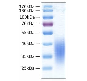 SDS-PAGE - Recombinant Human VISTA Protein (C-terminal His Tag) (A331422) - Antibodies.com