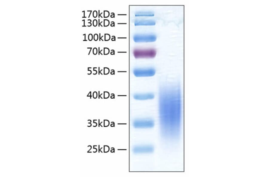 SDS-PAGE - Recombinant Human VISTA Protein (C-terminal His Tag) (A331422) - Antibodies.com