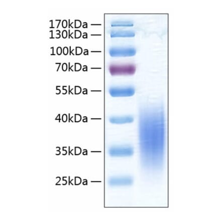 SDS-PAGE - Recombinant Human VISTA Protein (C-terminal His Tag) (A331422) - Antibodies.com