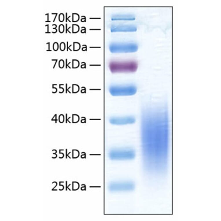 SDS-PAGE - Recombinant Human VISTA Protein (C-terminal His Tag) (A331422) - Antibodies.com