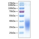 SDS-PAGE - Recombinant Human VISTA Protein (C-terminal His Tag) (A331422) - Antibodies.com