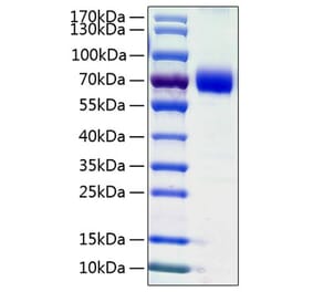 SDS-PAGE - Recombinant Human VISTA Protein (C-terminal Human Fc and His Tag) (A331423) - Antibodies.com