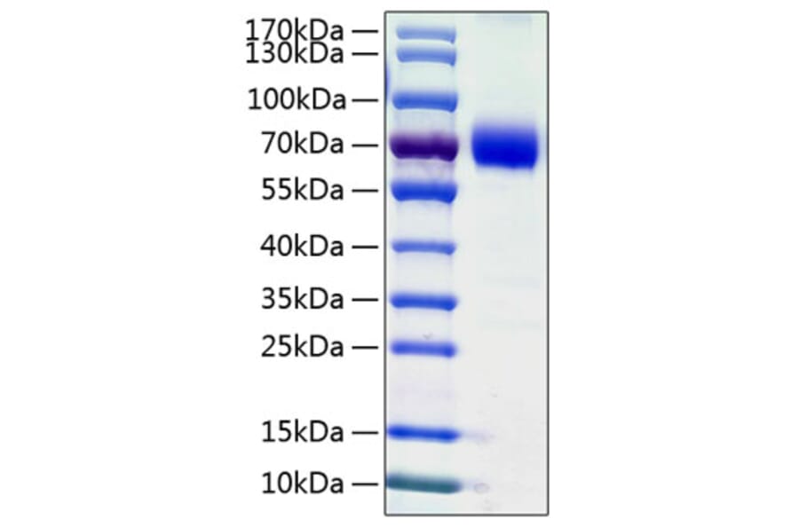 SDS-PAGE - Recombinant Human VISTA Protein (C-terminal Human Fc and His Tag) (A331423) - Antibodies.com