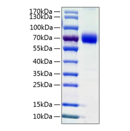 SDS-PAGE - Recombinant Human VISTA Protein (C-terminal Human Fc and His Tag) (A331423) - Antibodies.com