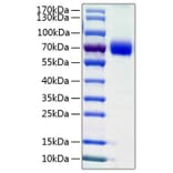 SDS-PAGE - Recombinant Human VISTA Protein (C-terminal Human Fc and His Tag) (A331423) - Antibodies.com