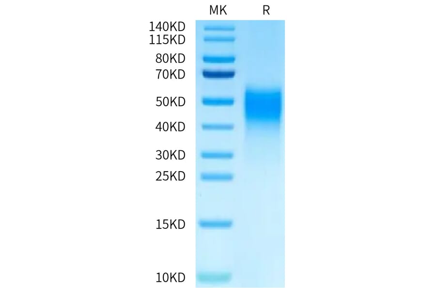 Tris-Bis PAGE - Recombinant Human VISTA Protein (Biotin) (C-terminal His and Avi Tag) (A331424) - Antibodies.com