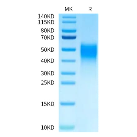 Tris-Bis PAGE - Recombinant Human VISTA Protein (Biotin) (C-terminal His and Avi Tag) (A331424) - Antibodies.com