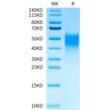 Tris-Bis PAGE - Recombinant Human VISTA Protein (Biotin) (C-terminal His and Avi Tag) (A331424) - Antibodies.com