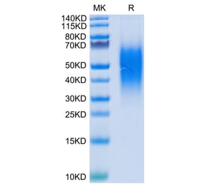 Tris-Bis PAGE - Recombinant Human VISTA Protein (C-terminal His Tag) (A331425) - Antibodies.com