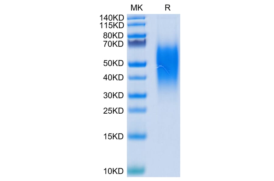 Tris-Bis PAGE - Recombinant Human VISTA Protein (C-terminal His Tag) (A331425) - Antibodies.com