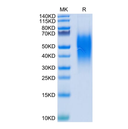 Tris-Bis PAGE - Recombinant Human VISTA Protein (C-terminal His Tag) (A331425) - Antibodies.com