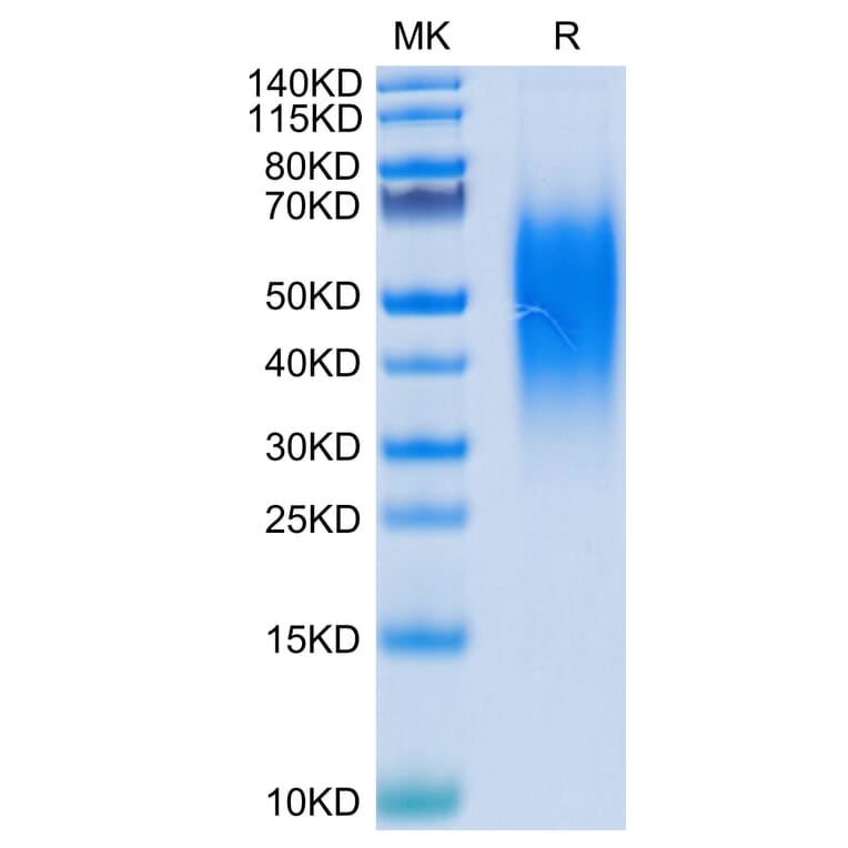 Tris-Bis PAGE - Recombinant Human VISTA Protein (C-terminal His Tag) (A331425) - Antibodies.com