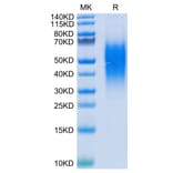Tris-Bis PAGE - Recombinant Human VISTA Protein (C-terminal His Tag) (A331425) - Antibodies.com