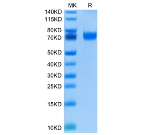 Tris-Bis PAGE - Recombinant Human VISTA Protein (C-terminal Human Fc Tag) (A331426) - Antibodies.com