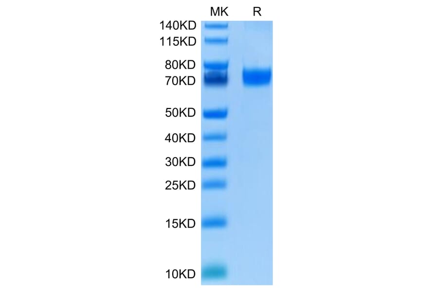 Tris-Bis PAGE - Recombinant Human VISTA Protein (C-terminal Human Fc Tag) (A331426) - Antibodies.com