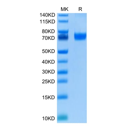 Tris-Bis PAGE - Recombinant Human VISTA Protein (C-terminal Human Fc Tag) (A331426) - Antibodies.com