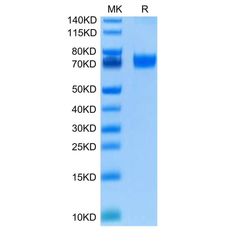 Tris-Bis PAGE - Recombinant Human VISTA Protein (C-terminal Human Fc Tag) (A331426) - Antibodies.com