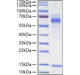 SDS-PAGE - Recombinant Human Vitronectin Protein (C-terminal His Tag) (A331427) - Antibodies.com