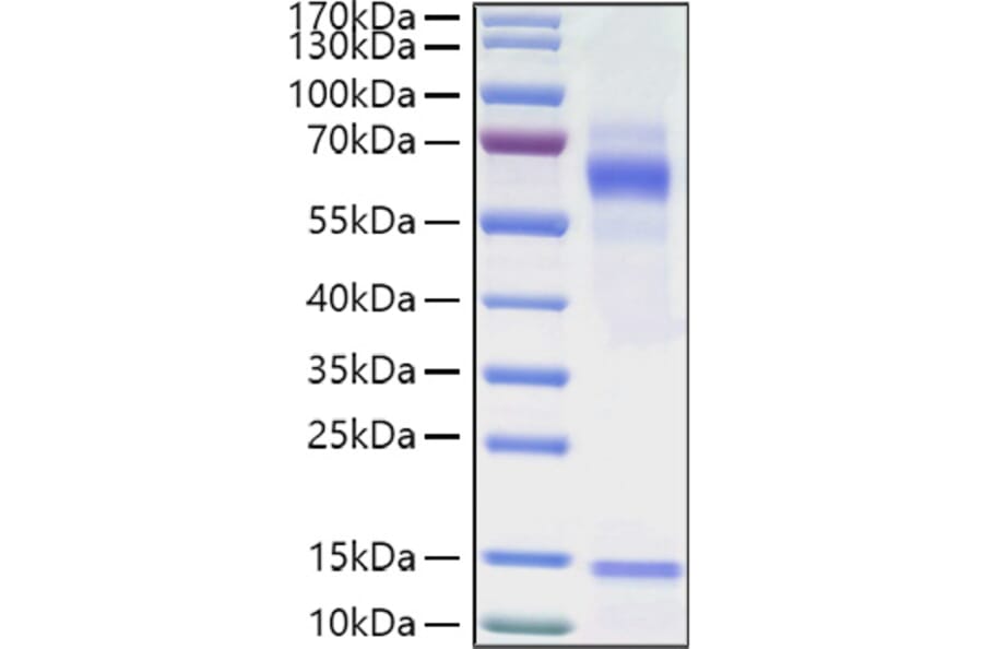 SDS-PAGE - Recombinant Human Vitronectin Protein (C-terminal His Tag) (A331427) - Antibodies.com
