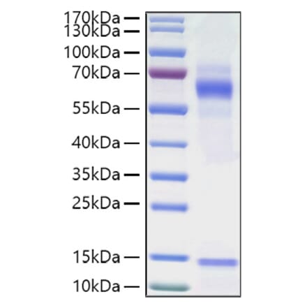 SDS-PAGE - Recombinant Human Vitronectin Protein (C-terminal His Tag) (A331427) - Antibodies.com