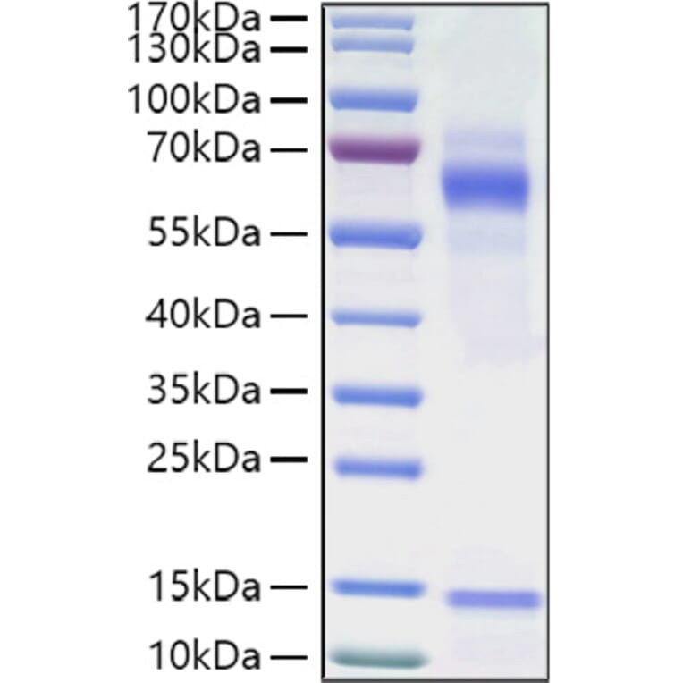 SDS-PAGE - Recombinant Human Vitronectin Protein (C-terminal His Tag) (A331427) - Antibodies.com