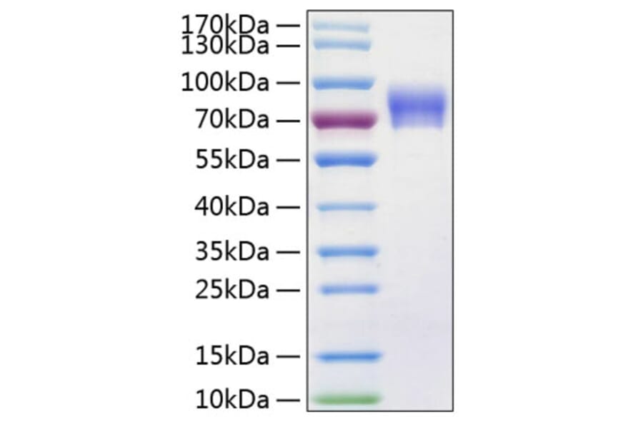 SDS-PAGE - Recombinant Human VNN1 Protein (C-terminal His Tag) (A331428) - Antibodies.com