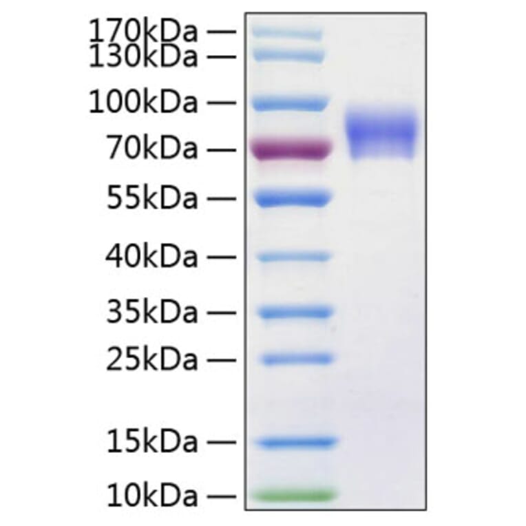 SDS-PAGE - Recombinant Human VNN1 Protein (C-terminal His Tag) (A331428) - Antibodies.com