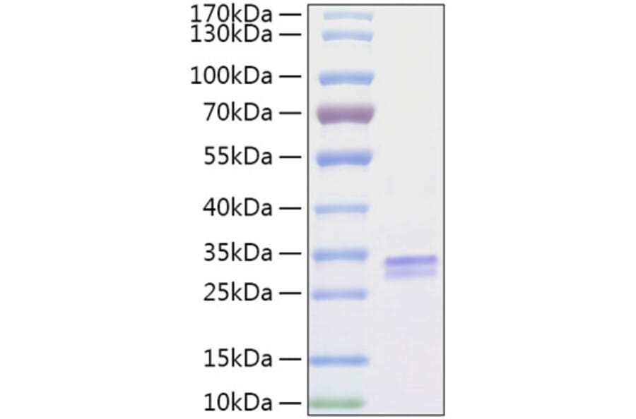 SDS-PAGE - Recombinant Human VSIG2 Protein (C-terminal His Tag) (A331429) - Antibodies.com