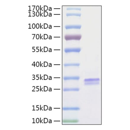 SDS-PAGE - Recombinant Human VSIG2 Protein (C-terminal His Tag) (A331429) - Antibodies.com
