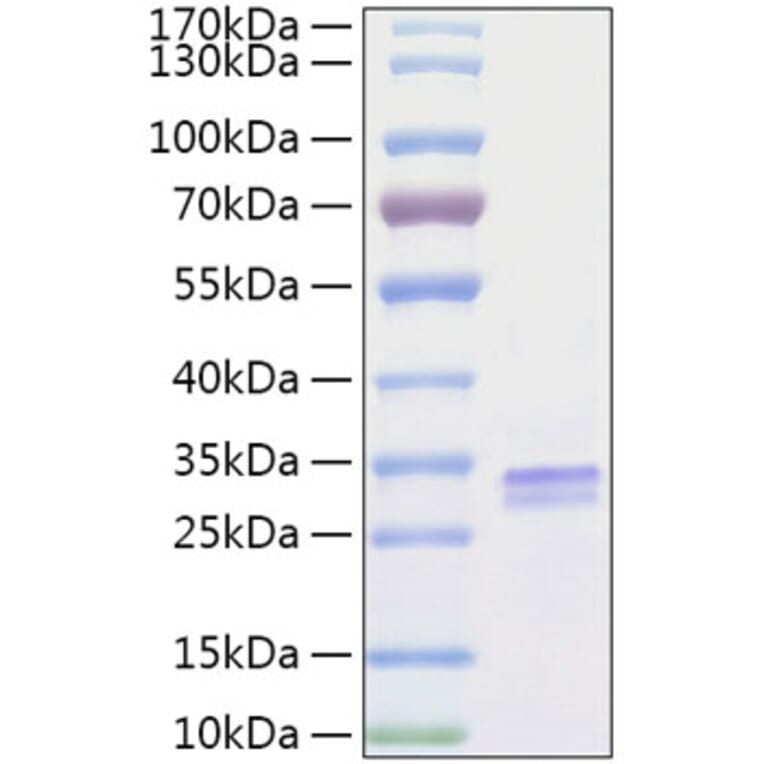 SDS-PAGE - Recombinant Human VSIG2 Protein (C-terminal His Tag) (A331429) - Antibodies.com