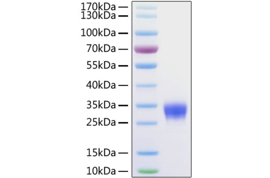SDS-PAGE - Recombinant Mouse VSIG4 Protein (C-terminal His Tag) (A331430) - Antibodies.com