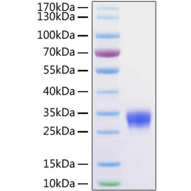 SDS-PAGE - Recombinant Mouse VSIG4 Protein (C-terminal His Tag) (A331430) - Antibodies.com
