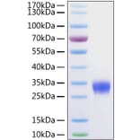 SDS-PAGE - Recombinant Mouse VSIG4 Protein (C-terminal His Tag) (A331430) - Antibodies.com