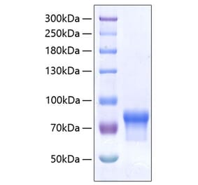 SDS-PAGE - Recombinant Human VSIG4 Protein (C-terminal Human Fc and His Tag) (A331431) - Antibodies.com