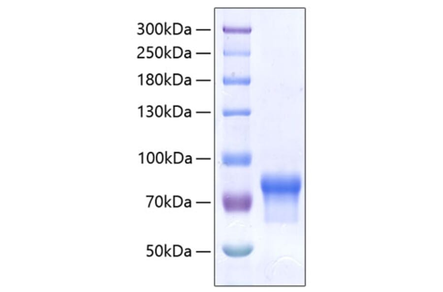 SDS-PAGE - Recombinant Human VSIG4 Protein (C-terminal Human Fc and His Tag) (A331431) - Antibodies.com