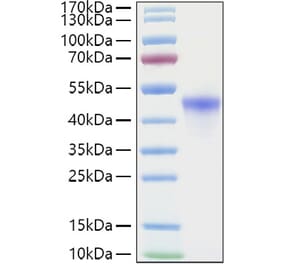 SDS-PAGE - Recombinant Human VSIG4 Protein (C-terminal His Tag) (A331432) - Antibodies.com