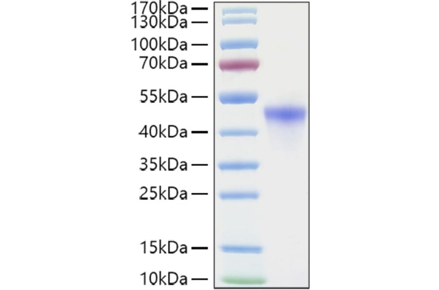 SDS-PAGE - Recombinant Human VSIG4 Protein (C-terminal His Tag) (A331432) - Antibodies.com