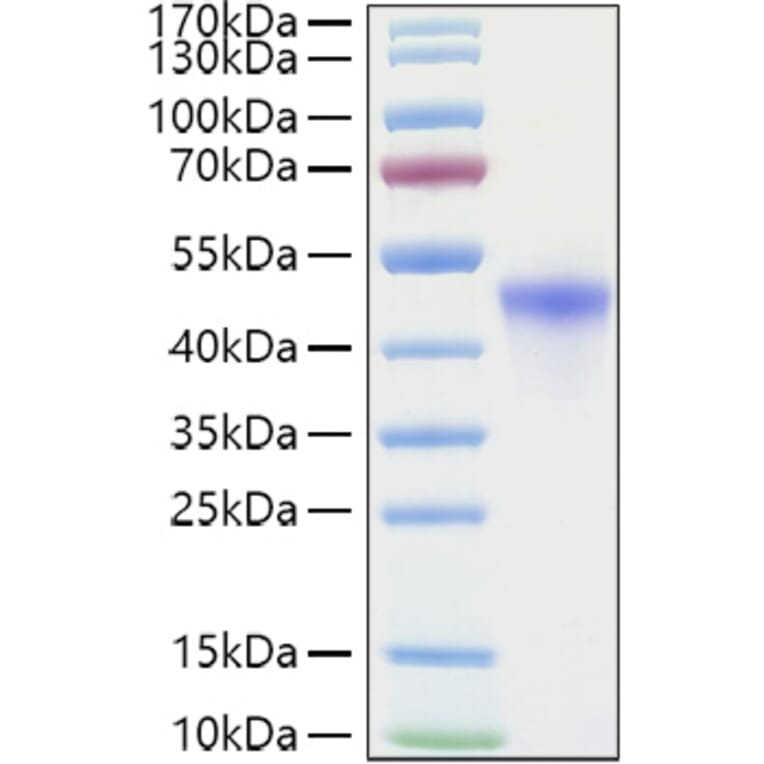 SDS-PAGE - Recombinant Human VSIG4 Protein (C-terminal His Tag) (A331432) - Antibodies.com