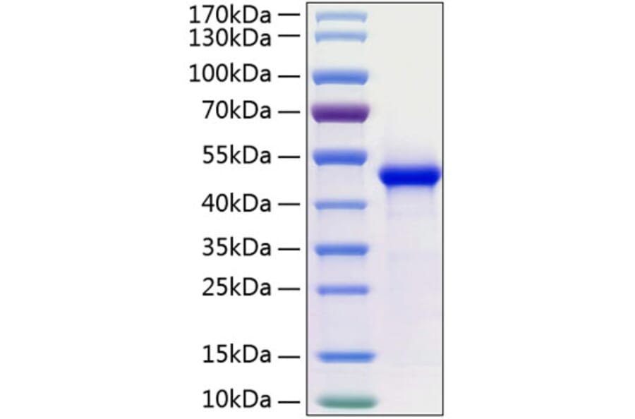 SDS-PAGE - Recombinant Human WIF1 Protein (C-terminal His Tag) (A331433) - Antibodies.com