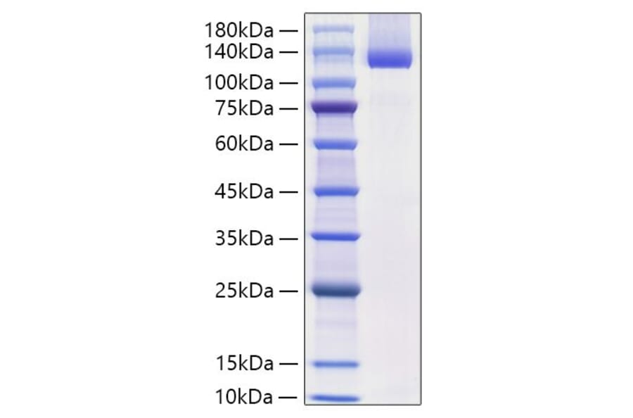 SDS-PAGE - Recombinant Mouse Neuropilin-1 Protein (C-terminal His Tag) (A331438) - Antibodies.com