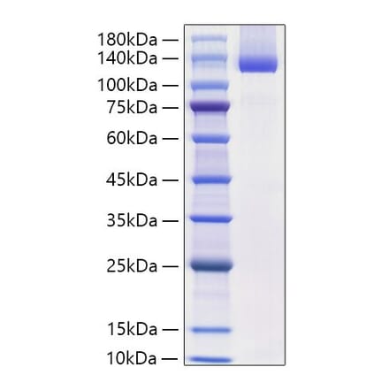 SDS-PAGE - Recombinant Mouse Neuropilin-1 Protein (C-terminal His Tag) (A331438) - Antibodies.com